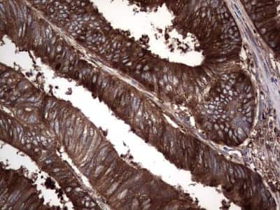 Immunohistochemistry: GARS Antibody (OTI4G4) [NBP2-45808]