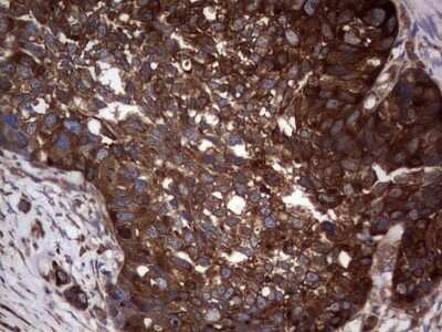 Immunohistochemistry: GARS Antibody (OTI4G4) [NBP2-45808]