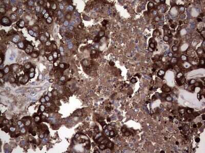 Immunohistochemistry: GARS Antibody (OTI4G4) [NBP2-45808]