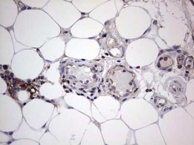 Immunohistochemistry: GARS Antibody (OTI4G4) [NBP2-45808]