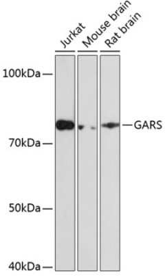 Western Blot: GARS Antibody (5Q5D7) [NBP3-15293]