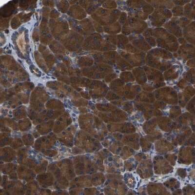 Immunohistochemistry-Paraffin: GARS Antibody [NBP1-85534]