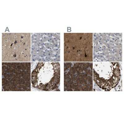 Immunohistochemistry-Paraffin: GARS Antibody [NBP1-85534]