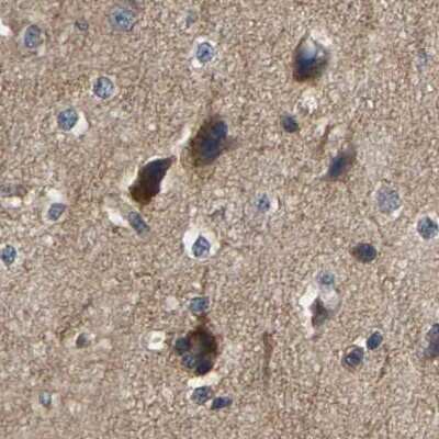 Immunohistochemistry-Paraffin: GARS Antibody [NBP1-85534]