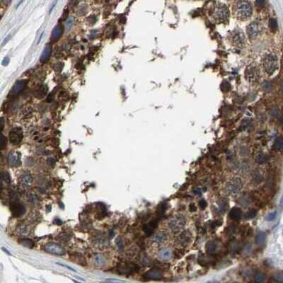 Immunohistochemistry-Paraffin: GARS Antibody [NBP1-85534]