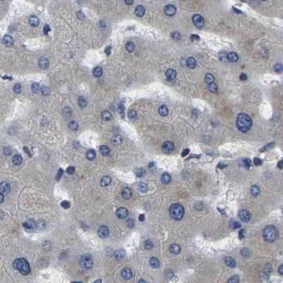 Immunohistochemistry-Paraffin: GARS Antibody [NBP1-85534]