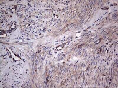 Immunohistochemistry: GARS Antibody (OTI4G4) - Azide and BSA Free [NBP2-70794]