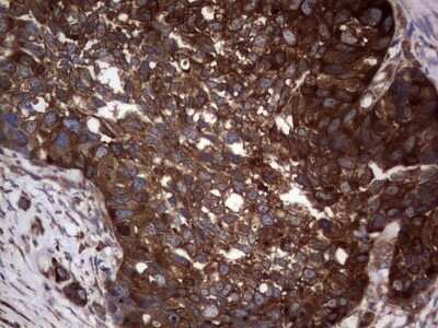 Immunohistochemistry: GARS Antibody (OTI4G4) - Azide and BSA Free [NBP2-70794]