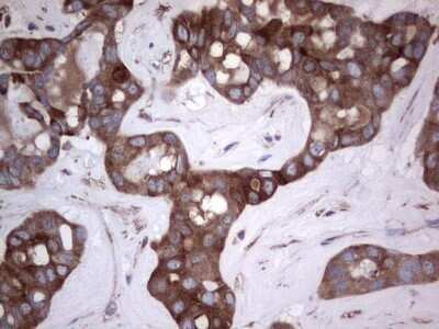 Immunohistochemistry: GARS Antibody (OTI4G4) - Azide and BSA Free [NBP2-70794]