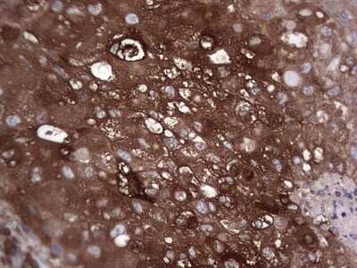 Immunohistochemistry: GARS Antibody (OTI4G4) - Azide and BSA Free [NBP2-70794]