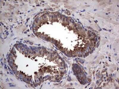Immunohistochemistry: GARS Antibody (OTI4G4) - Azide and BSA Free [NBP2-70794]