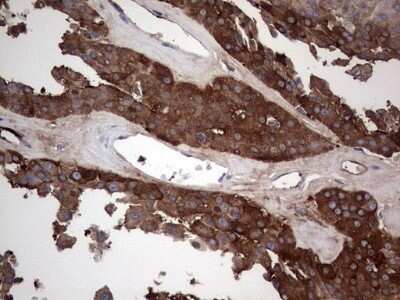 Immunohistochemistry: GARS Antibody (OTI4G4) - Azide and BSA Free [NBP2-70794]