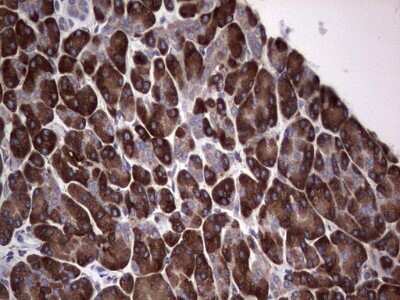 Immunohistochemistry: GARS Antibody (OTI4G4) - Azide and BSA Free [NBP2-70794]