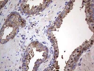 Immunohistochemistry: GARS Antibody (OTI4G4) - Azide and BSA Free [NBP2-70794]