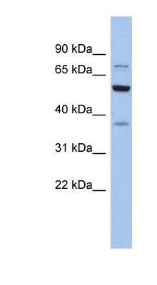 Western Blot: GARS Antibody [NBP1-54602]