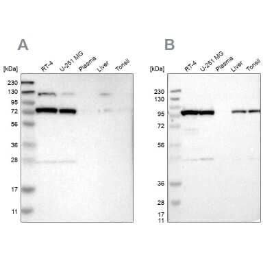 Western Blot: GARS Antibody [NBP1-85533]