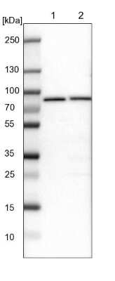 Western Blot: GARS Antibody [NBP1-85534]