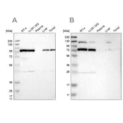 Western Blot: GARS Antibody [NBP1-85534]