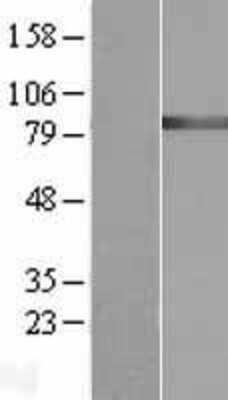 Western Blot: GARS Overexpression Lysate [NBL1-10970]