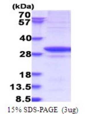 SDS-PAGE: Recombinant Human GARS His Protein [NBP2-51768]