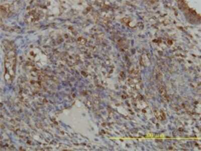 Immunohistochemistry-Paraffin: GART Antibody (4D6-1D5) [H00002618-M01]