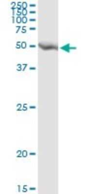 Immunoprecipitation: GART Antibody (4D6-1D5) [H00002618-M01]