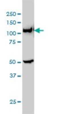 Western Blot: GART Antibody (4D6-1D5) [H00002618-M01]
