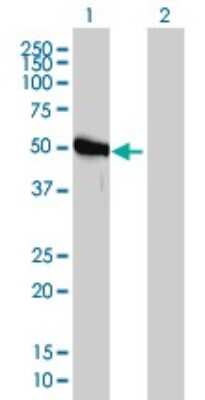 Western Blot: GART Antibody (4D6-1D5) [H00002618-M01]