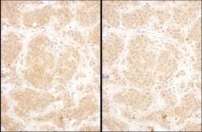 Immunohistochemistry: GART Antibody [NBP2-32206]