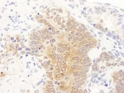 Immunohistochemistry: GART Antibody [NBP2-32206]