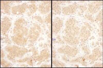Immunohistochemistry: GART Antibody [NBP2-32207]