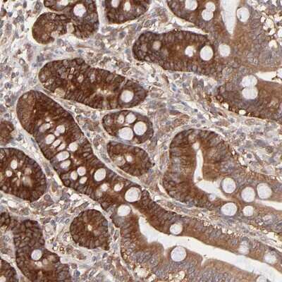 Immunohistochemistry-Paraffin: GART Antibody [NBP1-87290]