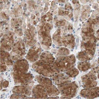 Immunohistochemistry-Paraffin: GART Antibody [NBP1-87291]