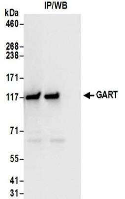 Immunoprecipitation: GART Antibody [NBP2-32206]