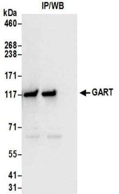 Immunoprecipitation: GART Antibody [NBP2-32207]