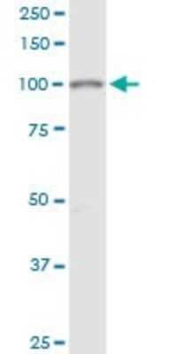 Western Blot: GART Antibody [H00002618-B01P]