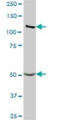 Western Blot: GART Antibody [H00002618-B01P]