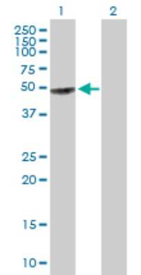 Western Blot: GART Antibody [H00002618-B01P]