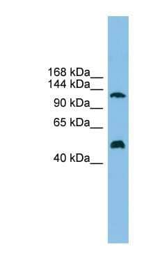 Western Blot: GART Antibody [NBP1-57774]