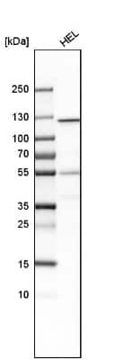 Western Blot: GART Antibody [NBP1-87290]