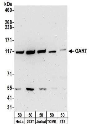 Western Blot: GART Antibody [NBP2-32206]