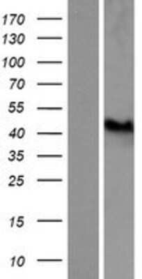 Western Blot: GART Overexpression Lysate [NBP2-05080]