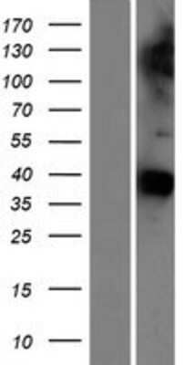 Western Blot: Gas1 Overexpression Lysate [NBP2-08152]