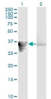 Western Blot: GAS2 Antibody (4E11) [H00002620-M01]