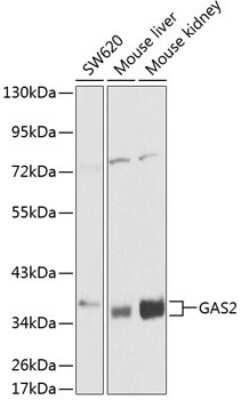 Western Blot: GAS2 AntibodyBSA Free [NBP3-04395]