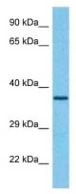 Western Blot: GAS2 Antibody [NBP3-10117]