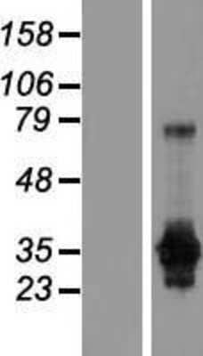 Western Blot: GAS2 Overexpression Lysate [NBL1-10971]