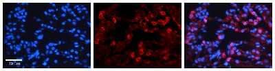 Immunohistochemistry: GAS2L1 Antibody [NBP1-58112]