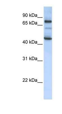 Western Blot: GAS2L1 Antibody [NBP1-58112]