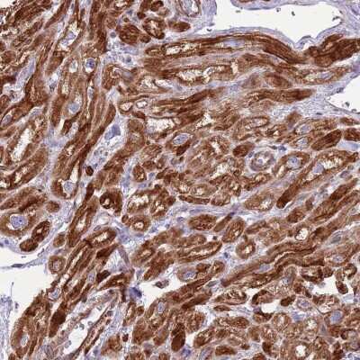 Immunohistochemistry-Paraffin: GAS2L3 Antibody [NBP2-33532]